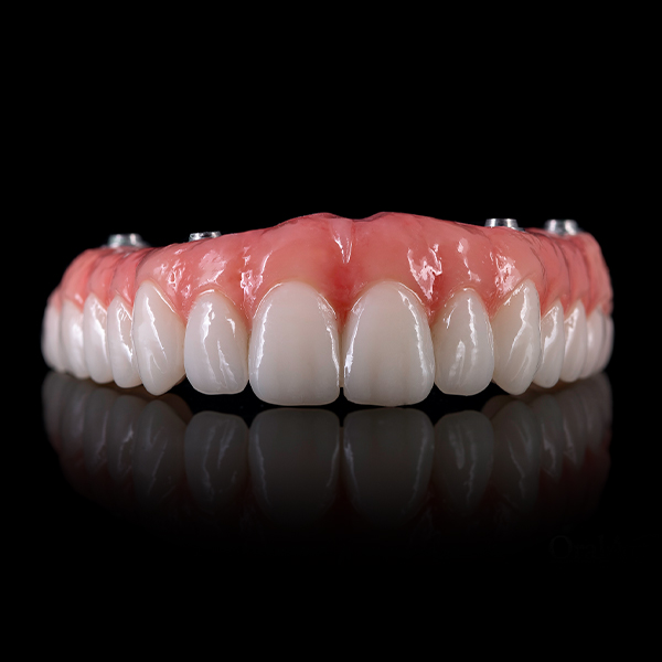 Implant Solution