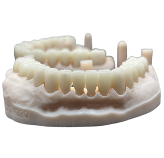 Emax Crown Emax Crown