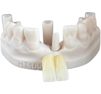 Screw Retained Screw Retained