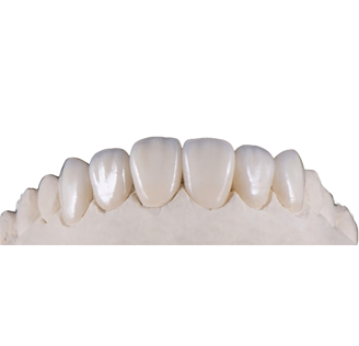 Veneer Veneer