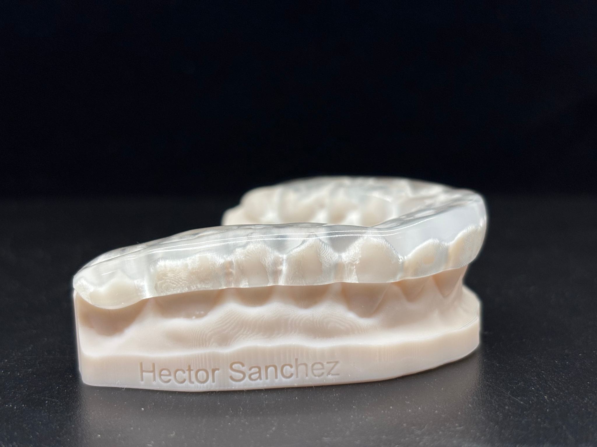 Removable Restoration