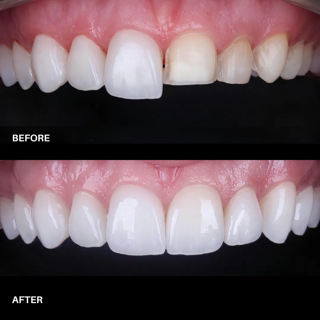 OEM & ODM Dental Lab Solutions OEM & ODM Dental Lab Solutions