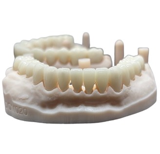 SDS Official Emax Crown