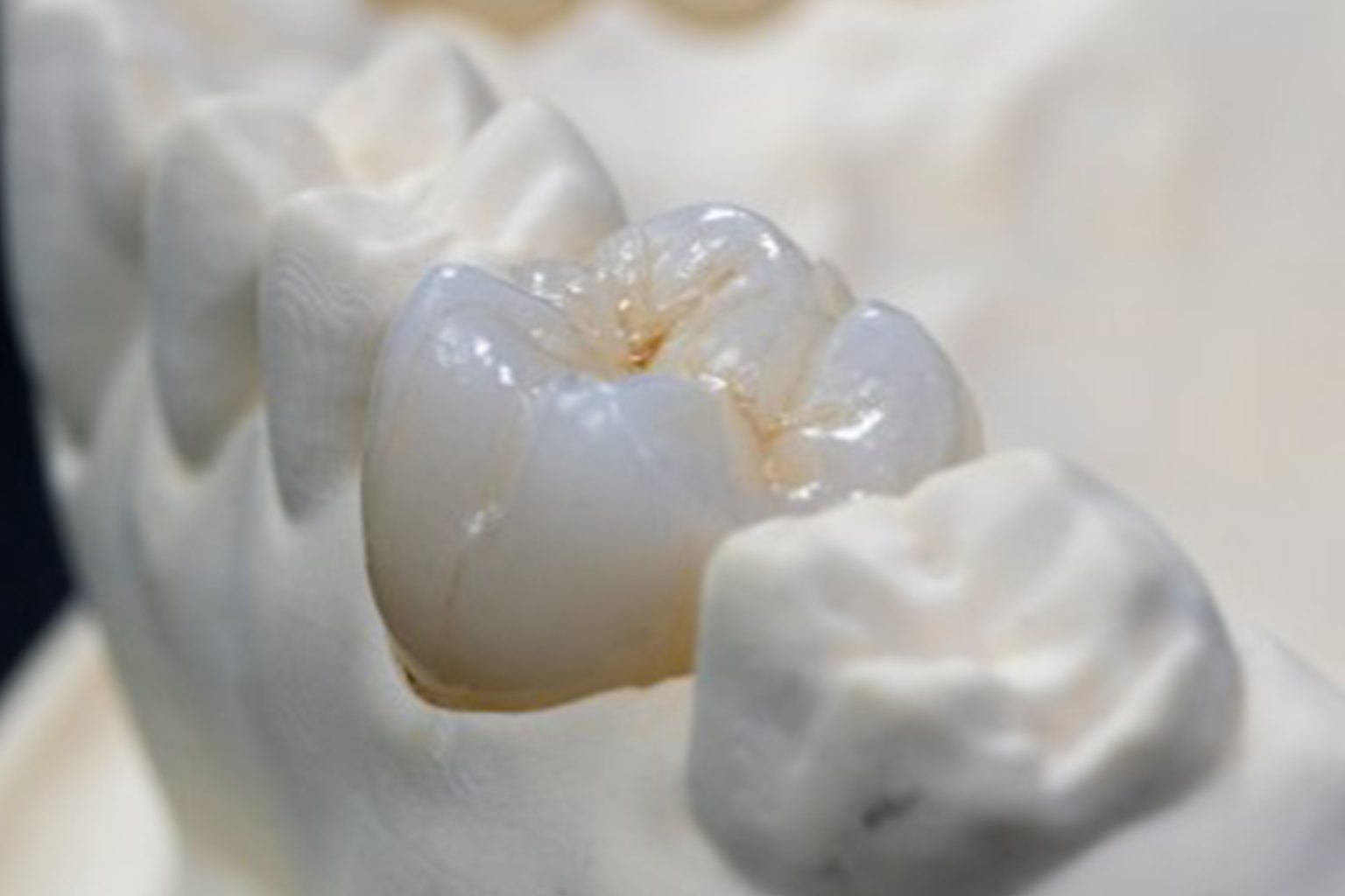 SDS Official Full Zirconia