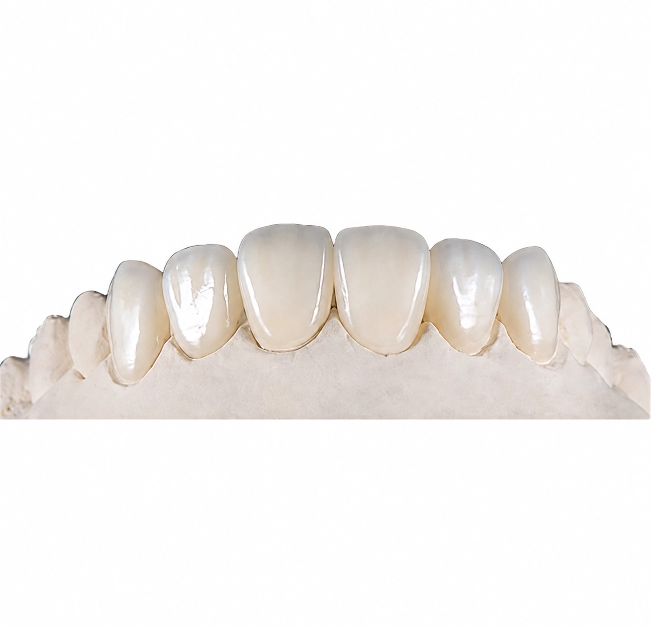Dental CAD Design or Manufacturing Outsourcing Which Service Model Fits Your Lab Dental CAD Design or Manufacturing Outsourcing Which Service Model Fits Your Lab
