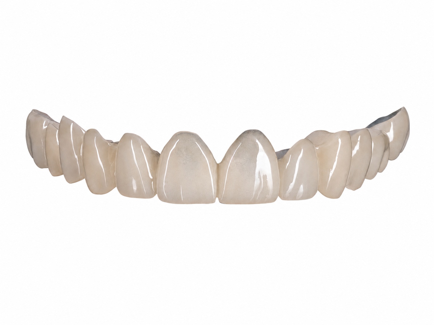 PMMA Bridge Outsourcing: What Dental Labs Should Confirm Before Production PMMA Bridge Outsourcing: What Dental Labs Should Confirm Before Production