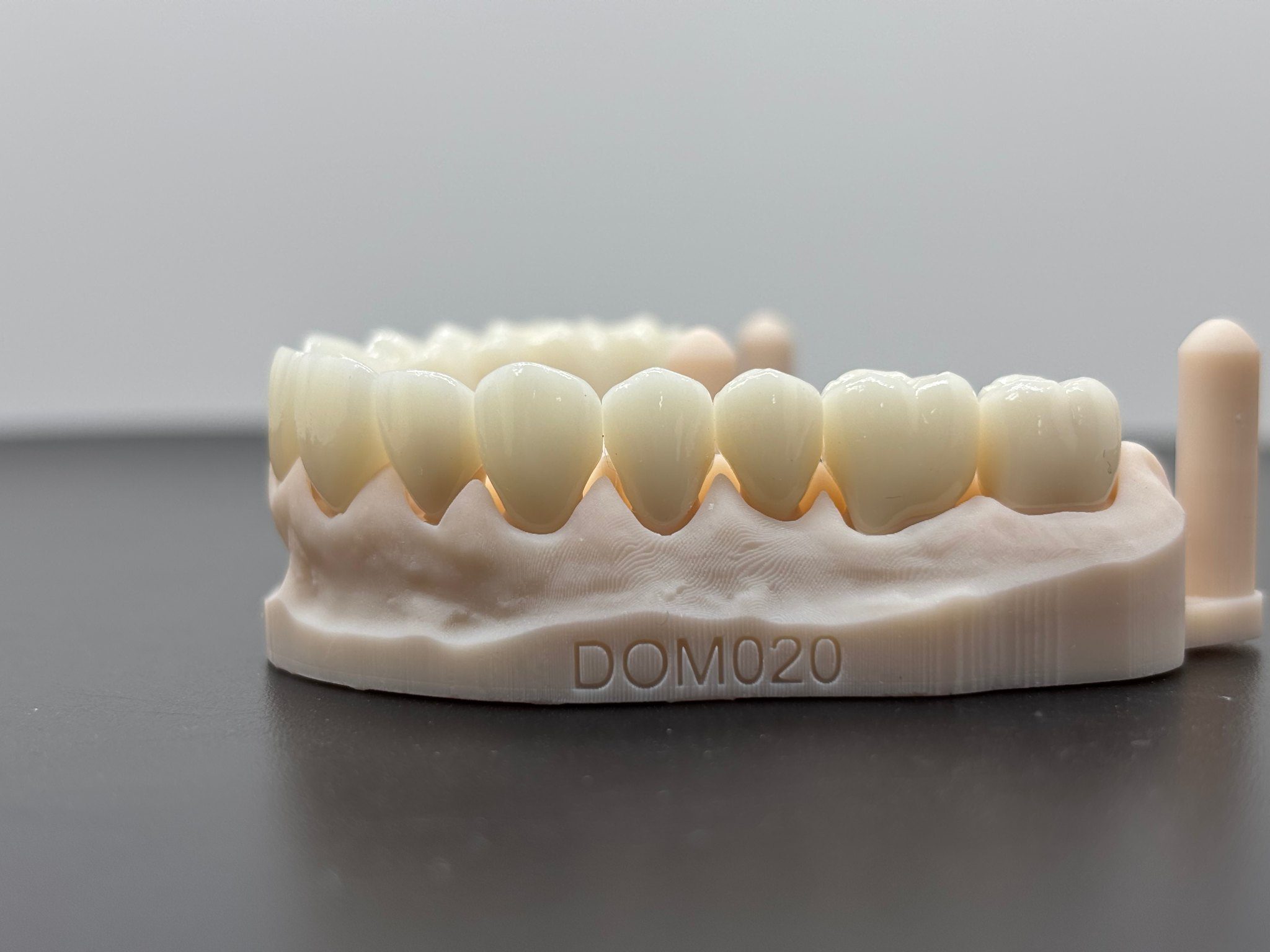 From Intraoral Scan to Final Dental Restoration From Intraoral Scan to Final Dental Restoration